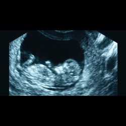Actus Contact Fm Video Un Bebe Applaudit Dans Le Ventre De Sa Maman A L Echographie Actus Contact Fm Video Un Bebe Applaudit Dans Le Ventre De Sa Maman A L Echographie