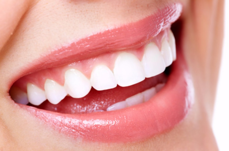 Souriez ! C'est bon pour la santé !
