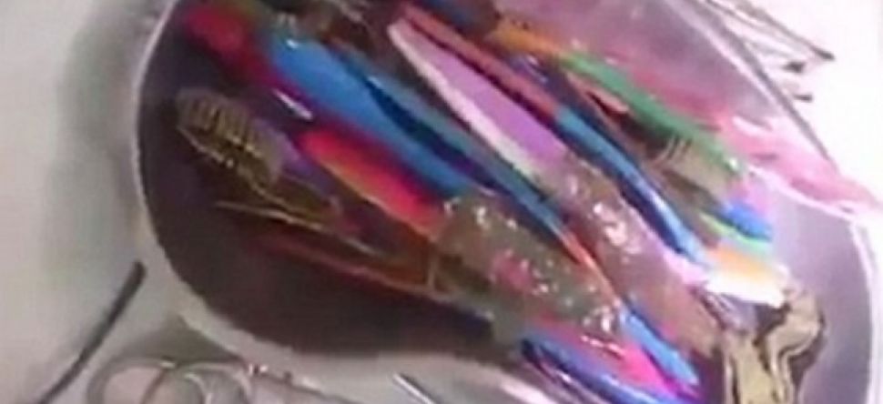 Il avait 18 brosses à dents dans son estomac