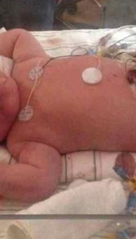 Une Femme Accouche D Un Bebe De 7 Kilos Photos